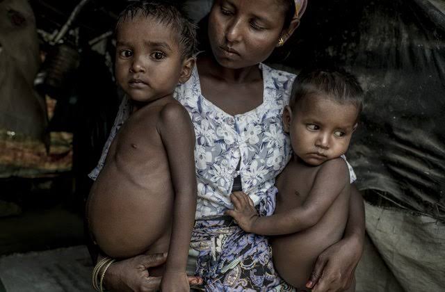 Poorest nations confronting both fatness and undernourishment